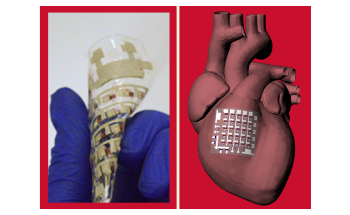 New Cardiac Patch Tracks Heart Condition and Supports Treatment