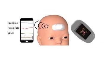 World’s First Wearable Device to Measure Neonatal Jaundice and Vitals