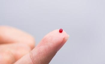 Novel Microchip Sensor Measures Stress Hormones in Real-Time