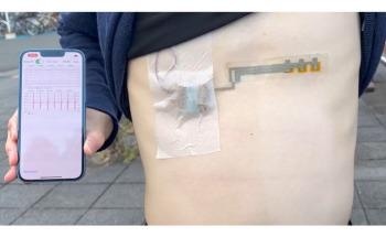 Researchers Discover Wireless, Wearable, Flexible Electrocardiogram Sensor System