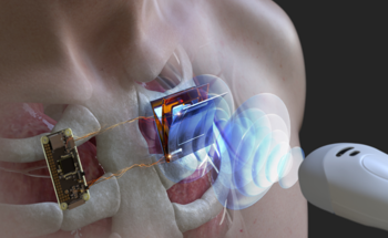 Research Highlights New Ultrasonic Wireless Power Charging Technique