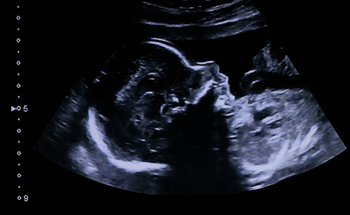 New Sensing Glove to Transmit Data on Fetal Position