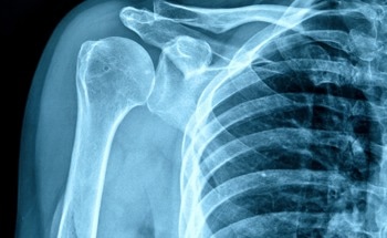 Flexible Organic Semiconductors Revolutionize X-Ray Detection