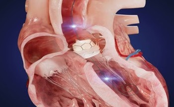 Xenter Unveils Groundbreaking Investigational Dual Sensor Wireless GuideWire for Minimally Invasive TAVR Procedures at TCT 2023