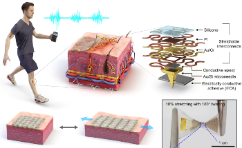 Wearable Electrophysiological Sensor Provides Precise EMG Measurements