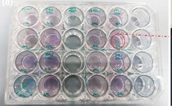 New Biosensor Detects Skin Cancer With THz Waves