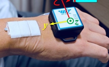 Enhancing Rehabilitation Progression With Wearable Sensor Technology