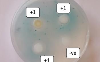 Nanomaterial Biosensors for Industrial Bacteria Detection