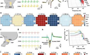Microneedle Patches Boost Electrophysiology Accuracy