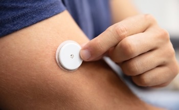 Carbon Nanofiber Sensor Revolutionizes Glucose Detection