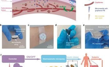 Microneedle Patch Revolutionizes Diabetes Management
