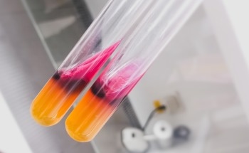 HEK-hTLR5 Biosensor Speeds Up Salmonella Detection