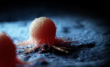 HKDC1 Glucose Sensor Regulates Cancer Metabolism