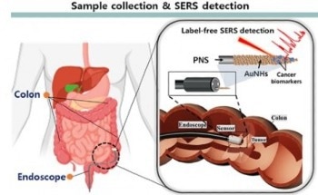 Harnessing the Power of AI and Plasmonics for Early Cancer Detection