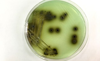 Biosensor Detects Salmonella with Ultrafast Sensitivity