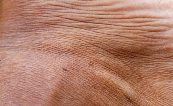 Revolutionizing On-Skin Prototyping with the SkinLink Toolkit