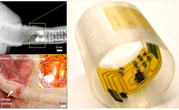 Wireless Sensing Technology for Early Disease Detection in Airways