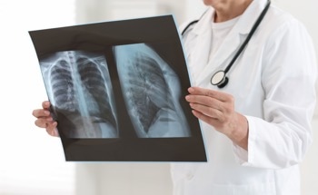Detecting Lung Cancer with Nanoscale Breath Sensors