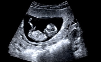 New Smart Sensor Tracks Your Baby’s Movements in Real Time