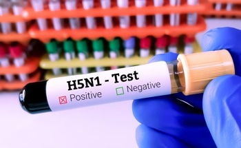 New Biosensor Detects Airborne H5N1 and E. coli in Under Five Minutes