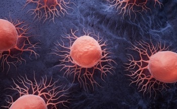 Wearable T-Shirt for Remote Monitoring After Cancer Surgery