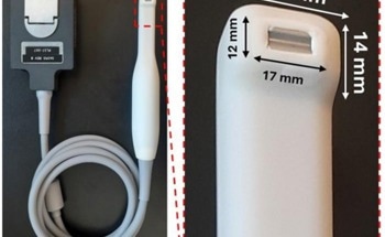 Ultrasound Offers Less Invasive Gum Disease Screening