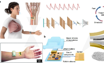 AI-Powered Wristband Revolutionizing Respiratory Monitoring