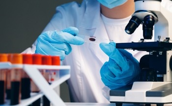 Early Detection of Alzheimer's Disease with Novel Graphene Foam Sensor