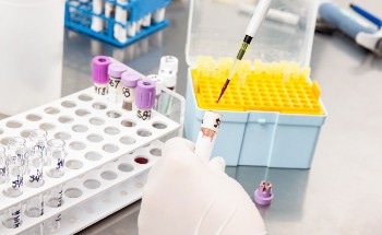 Biosensor Tracks Antibody Secretion for Biomanufacturing