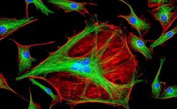 Self-sufficient Cells Light Up Enzyme Activity from Within