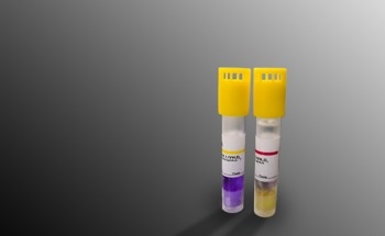 Tracking Reactive Species Opens Path to Plasma Diagnosis