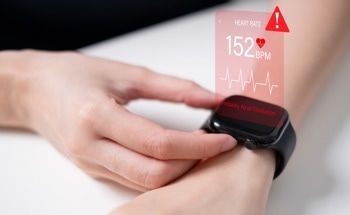 Smartphone-Sensor System Not Yet Ready to Detect Arrythmia in High Risk Patients