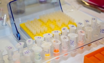 CalLuc-2.1: A Luminescent Biosensor For GPCR Calcium Signalling