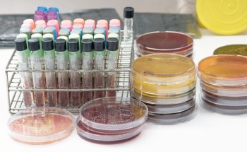 Fluorescence Sensor Arrays Enable Rapid Bacterial Fingerprinting