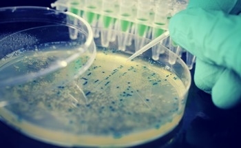 Carbon Dot Biosensor Detects E. coli DNA
