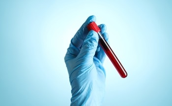 Microwave Metamaterial Biosensor Shows Promise for Label-Free Blood Analysis